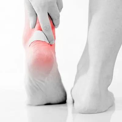 突然脚跟疼痛，不敢用力，走路都不行了