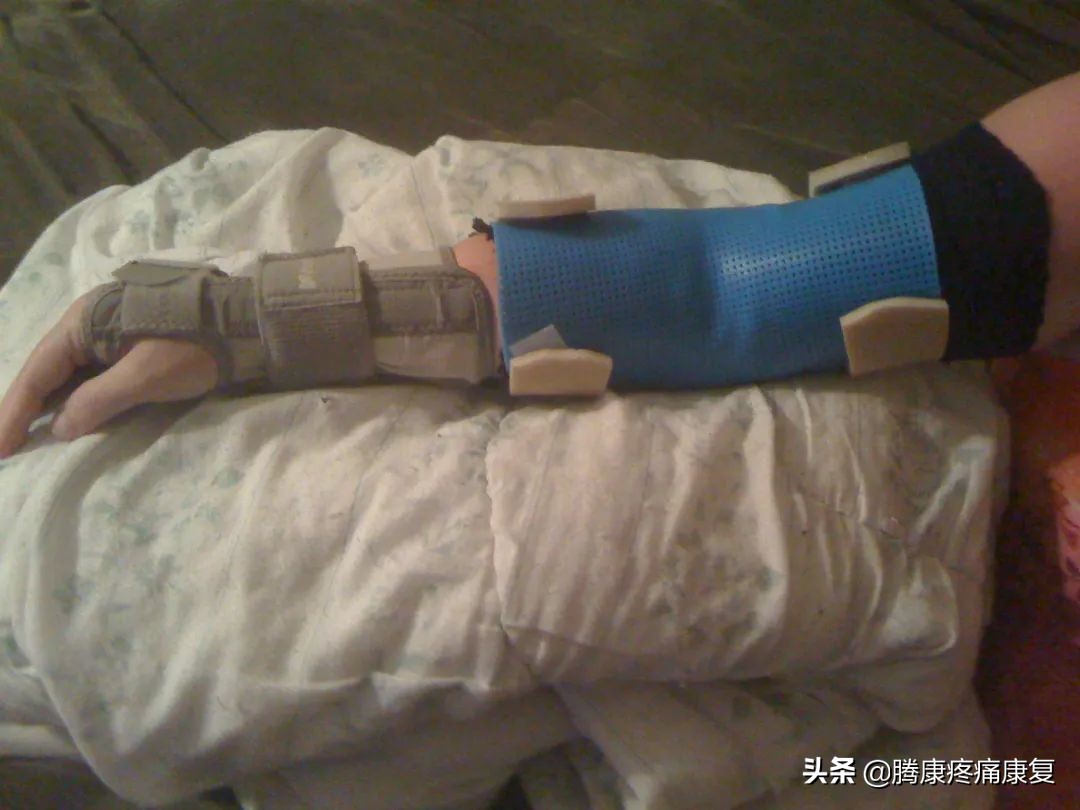 胳膊与肩膀相连处疼痛是什么原因,左胳膊上臂疼痛是什么原因造成的