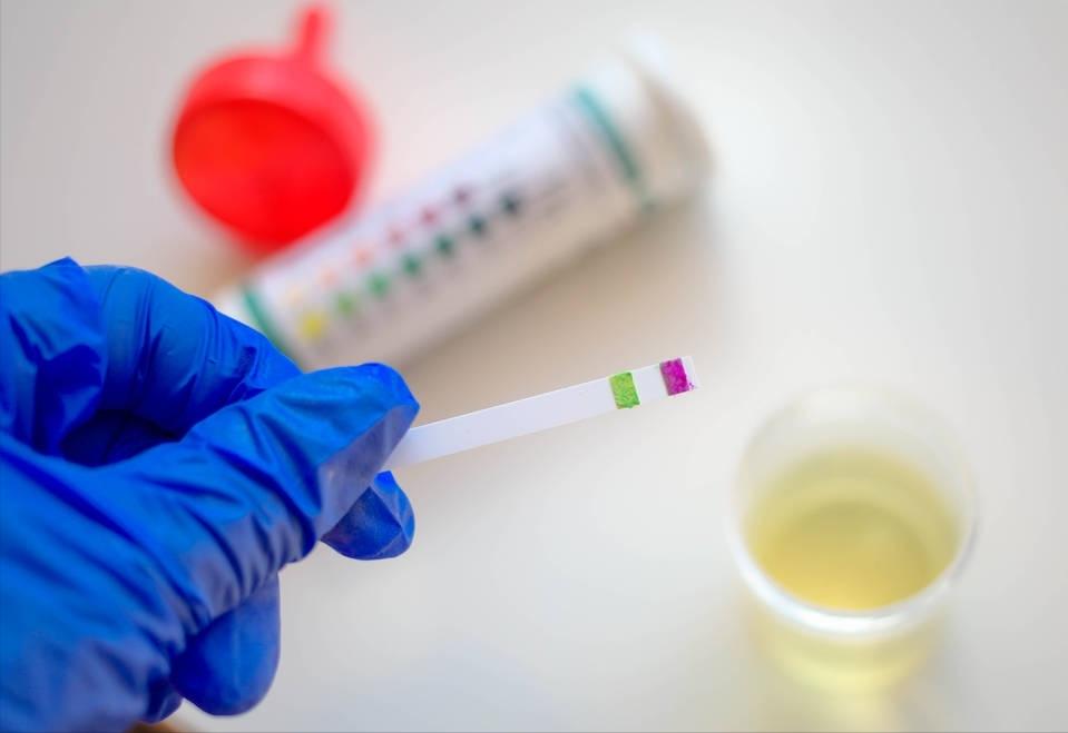 发现尿蛋白有什么中成药能治疗,发现尿蛋白1+还有红细胞