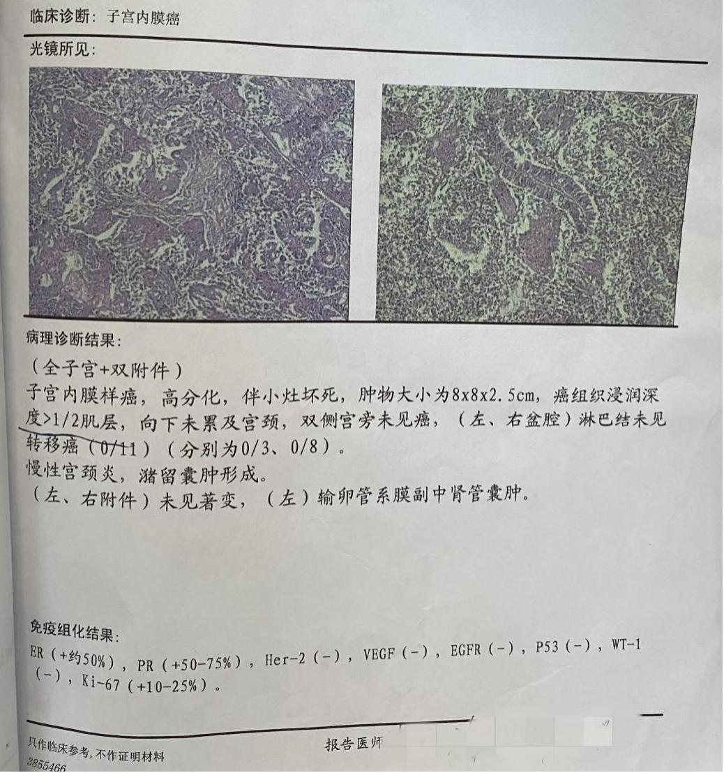 子宫内膜癌现在一直流血,子宫内膜增厚流血是癌吗