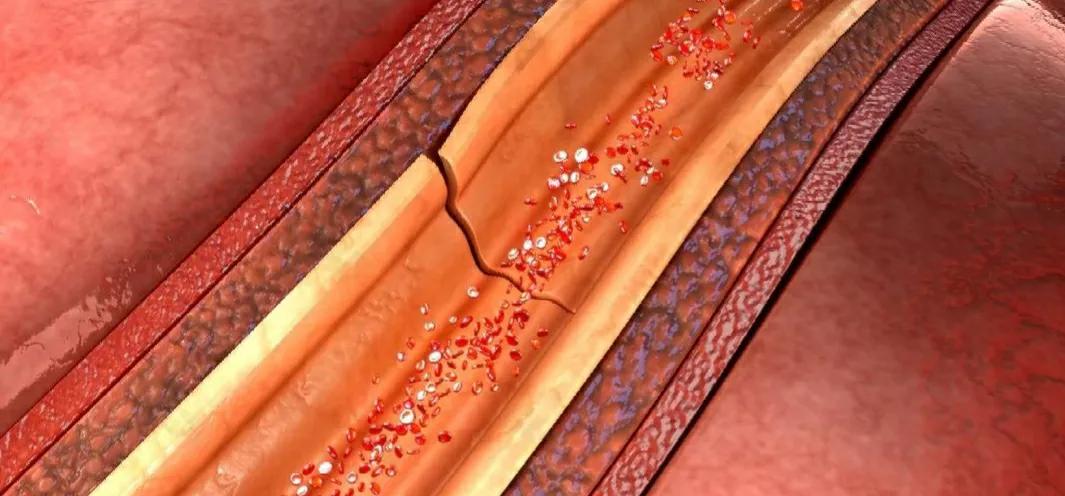 男子腹痛确疑病症,男子腹痛难忍医生怀疑