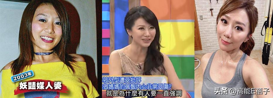 台湾艺人整形记：削骨换脸小场面，嫁给医师保修终身