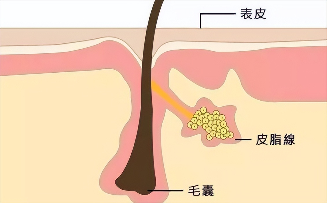 女性的毛发有什么作用,女性如何处理生理性毛发