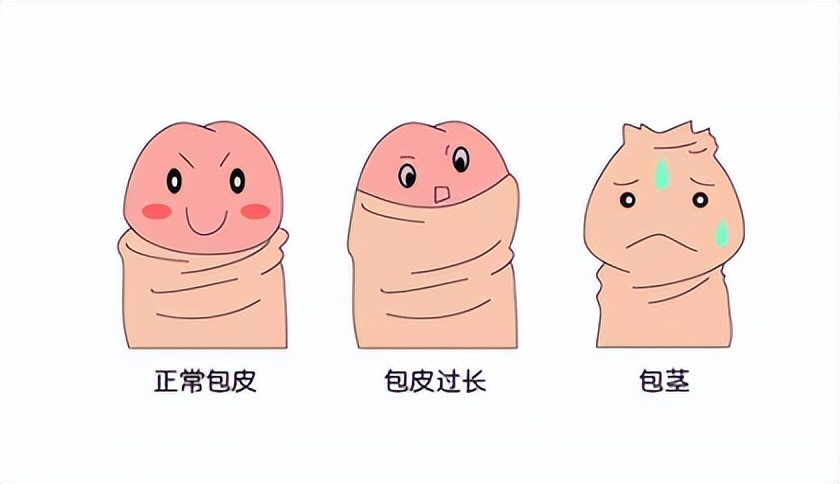 是不是所有的宝宝都要割包皮,出生的宝宝要不要割包皮