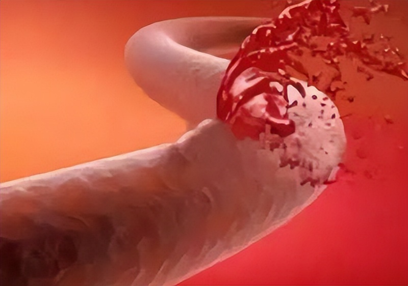 口服阿司匹林肠溶片需要注意什么,阿司匹林与阿托伐他汀钙吃多久