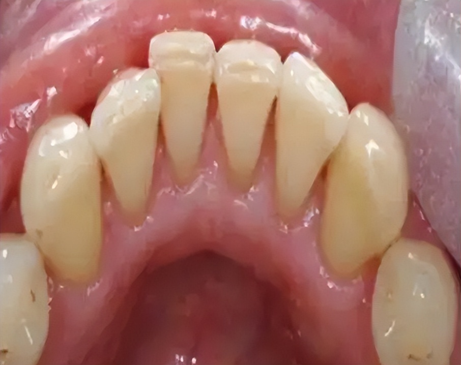 好用的国货去牙黄牙渍,去除牙渍最好的牙粉测评