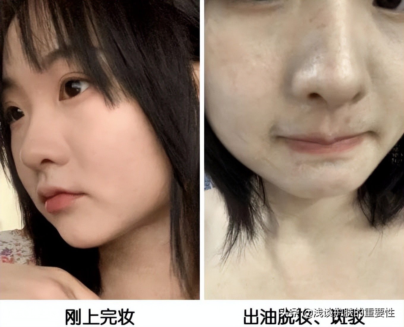 油性肌肤天热出油多怎么办,为什么油性肌肤老出油