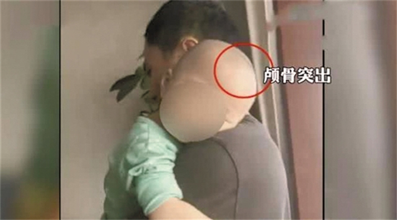 三聚氰胺奶粉事件有儿童死亡吗,三聚氰胺害死了多少人