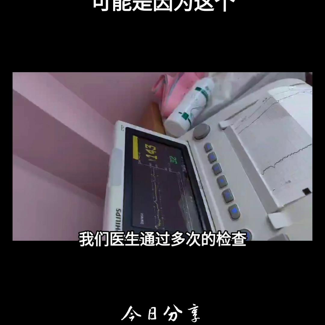 胎心监护不过关是不是需要再付费,胎心监护不过160正常吗