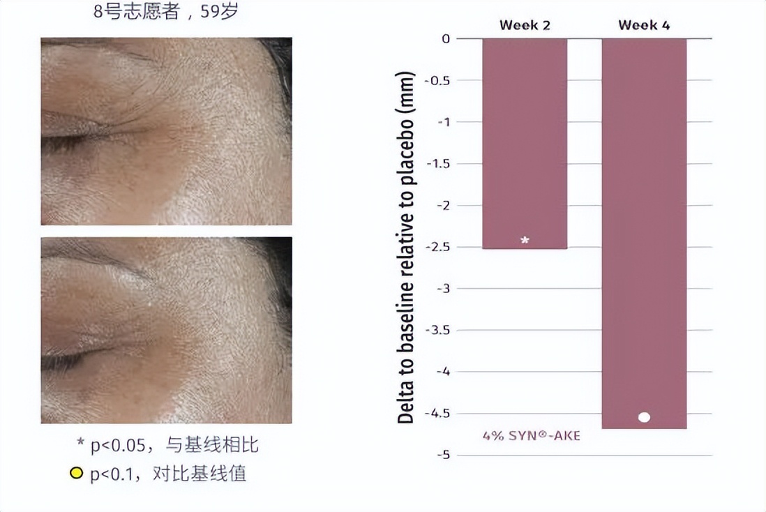 知道它的人不多，但四五十岁女性用了真的能淡纹，值得一看