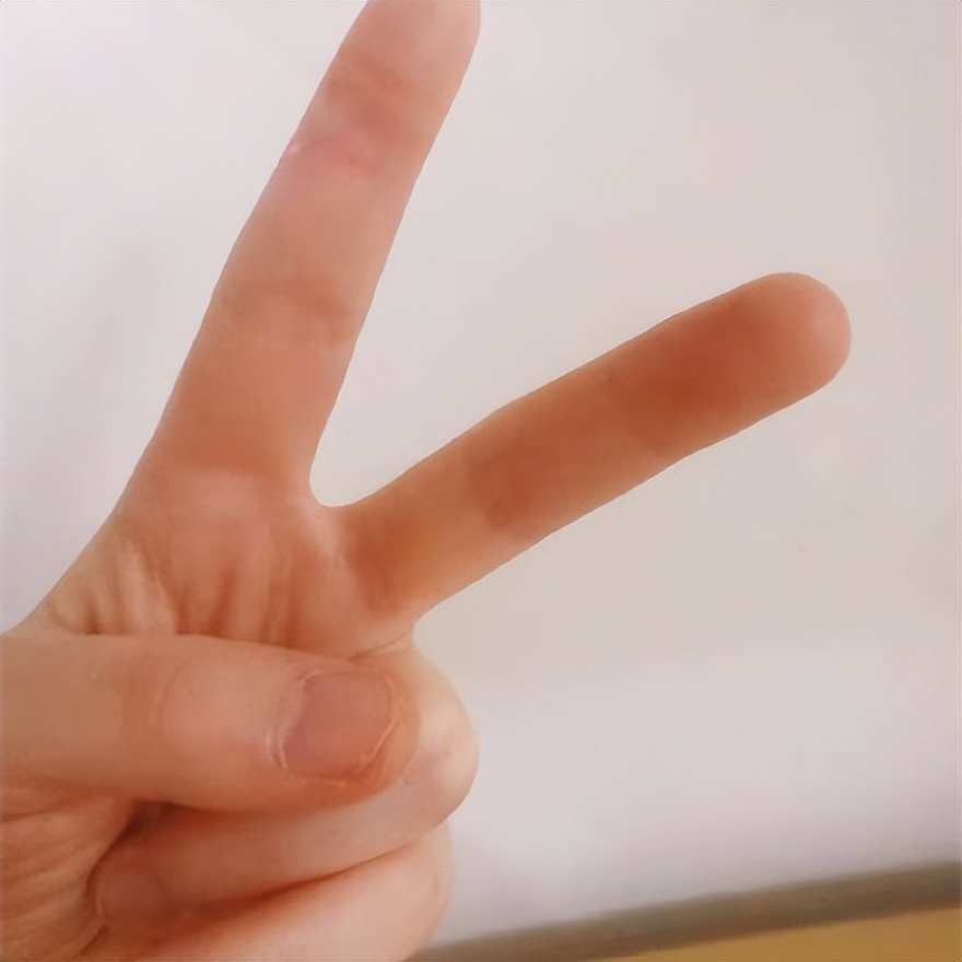 手脚总是出汗去中医院挂什么科,手脚总是出汗怎么治