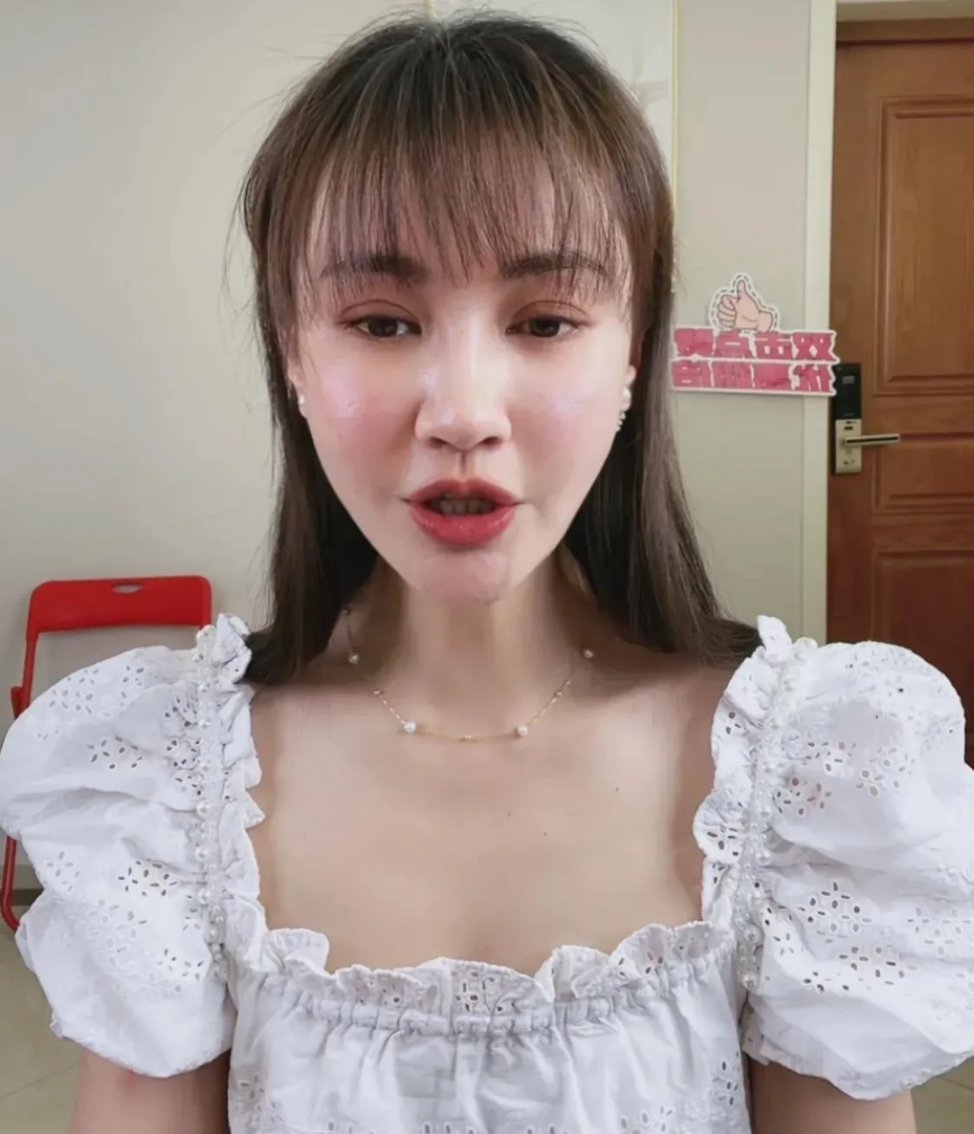 最近脸僵硬的女星,脸部变僵硬的女明星