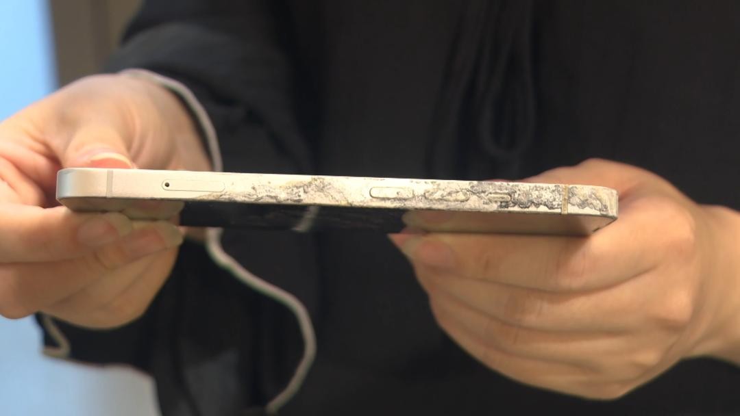 女孩玩苹果手机遭电击截肢,17岁女孩边充电边玩iphone遭电击