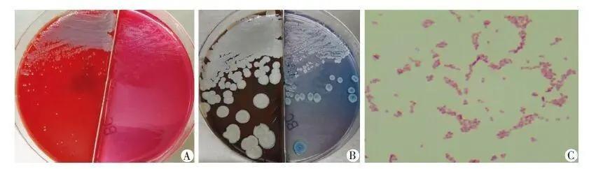 美国土壤和水中惊现类鼻疽病原菌，致死率50%！可怕，人普遍易感