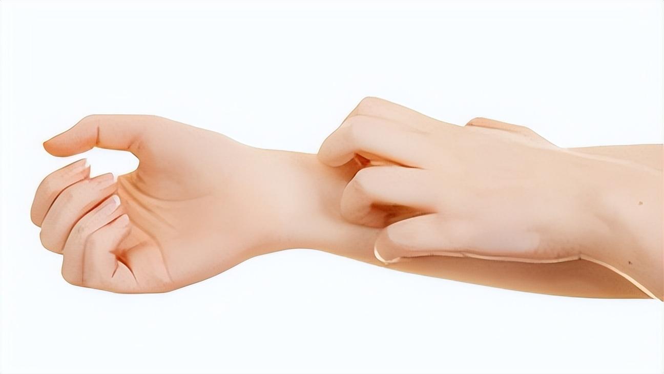 血糖刚发现偏高怎么办,血糖高不高看手上三个变化