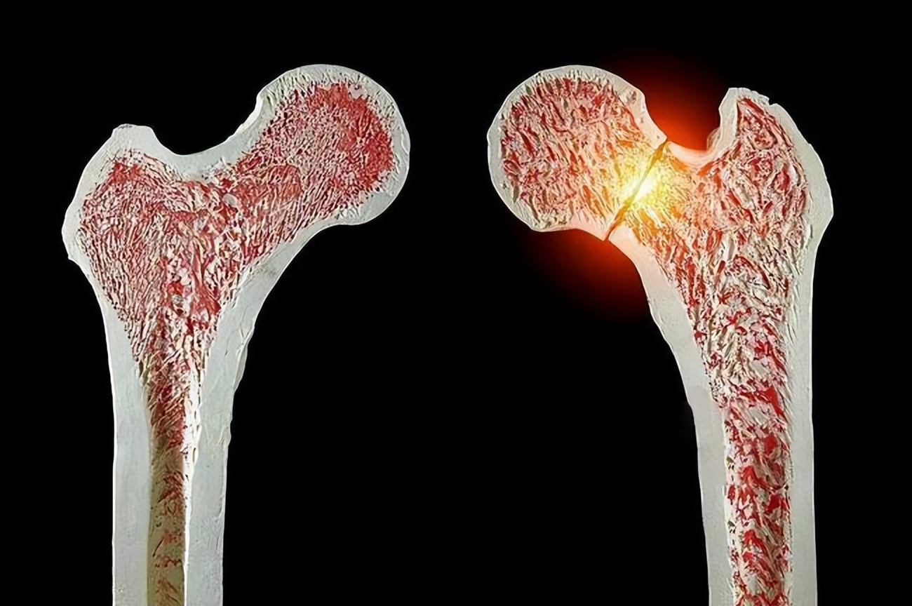 富血小板血浆因子作用,富血小板血浆治疗的目的和意义