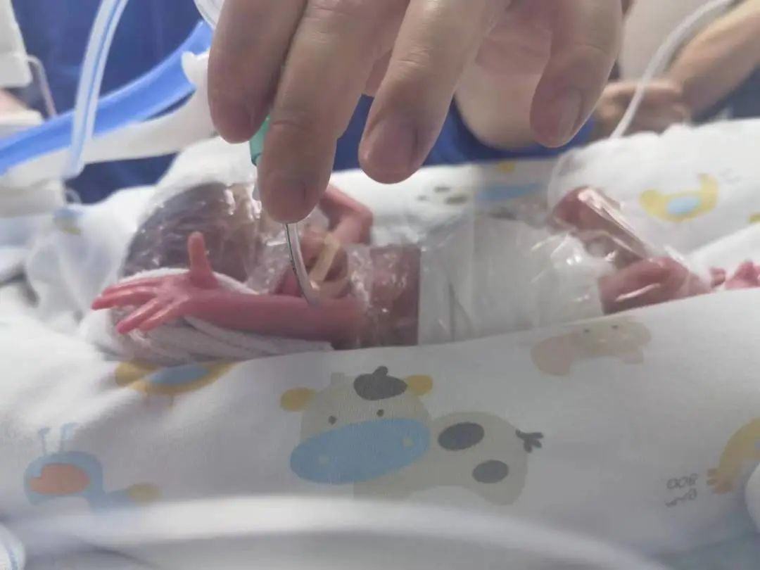 650g、850g、相隔3天出生！这对双胞胎如何“闯”出生命奇迹？