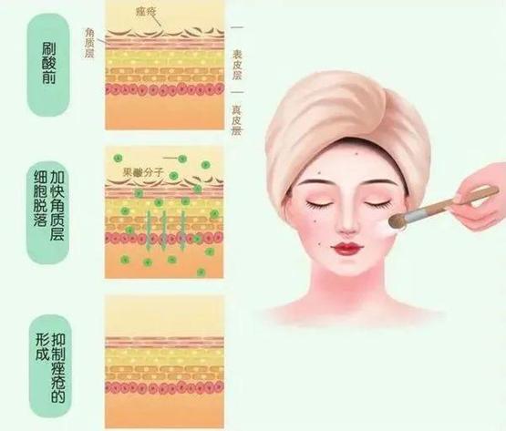 您想知道的“刷酸”知识都在这儿！