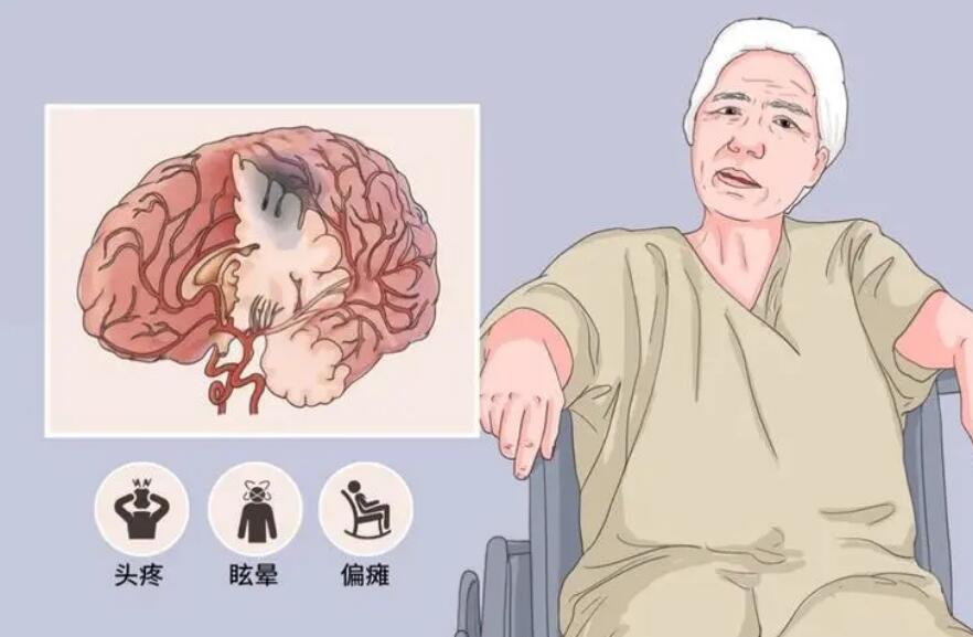 中风前兆如何预防中风,中风前有哪些症状如何预防中风