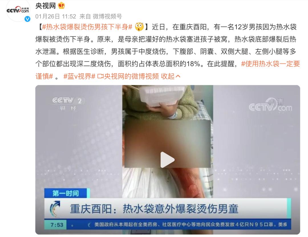 烫伤的紧急处理方法,烫伤紧急处理的第一步是