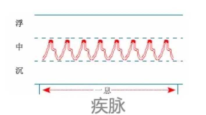 中医28脉诊歌诀及示意图,中医28脉全部脉象图解