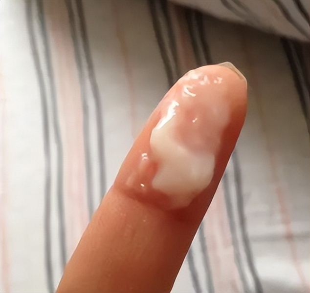 女性阴道有白色泡沫排出来，是咋回事？暗示了什么？医生给出答案
