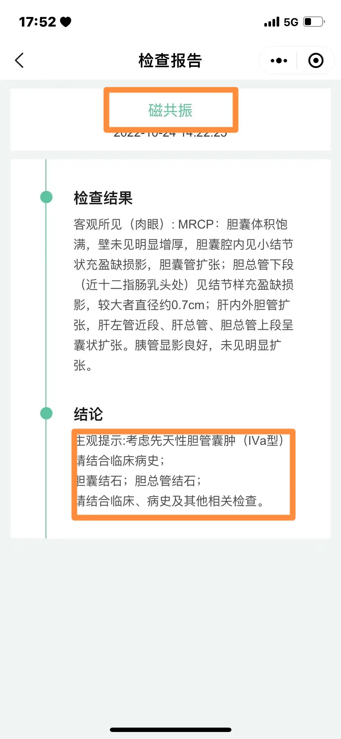 上火会导致尿液发黄吗,小便发黄是体内有火吗