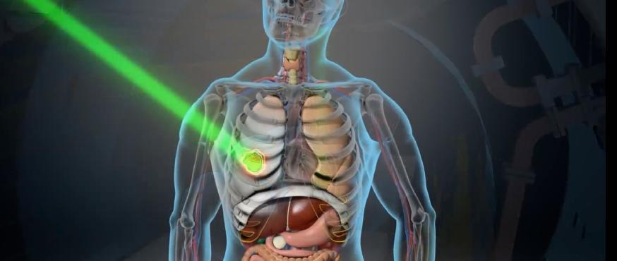 复星布局，全球首创MRI引导放疗系统获批NMPA