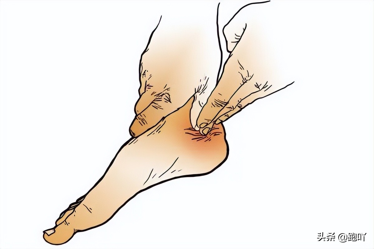 三个动作教你居家缓解足底筋膜炎,足底筋膜炎十大膏药