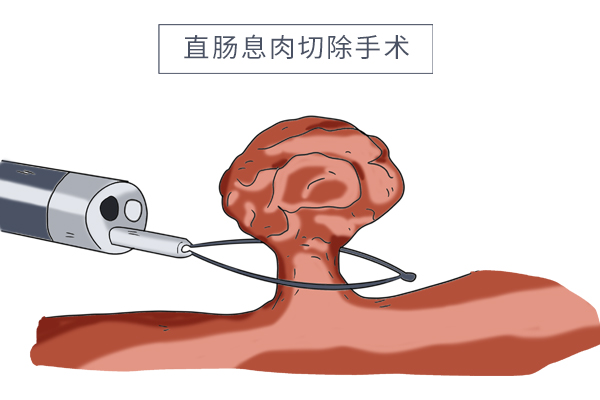 放屁多不是排毒而是这4种原因,放屁多是什么病的前兆