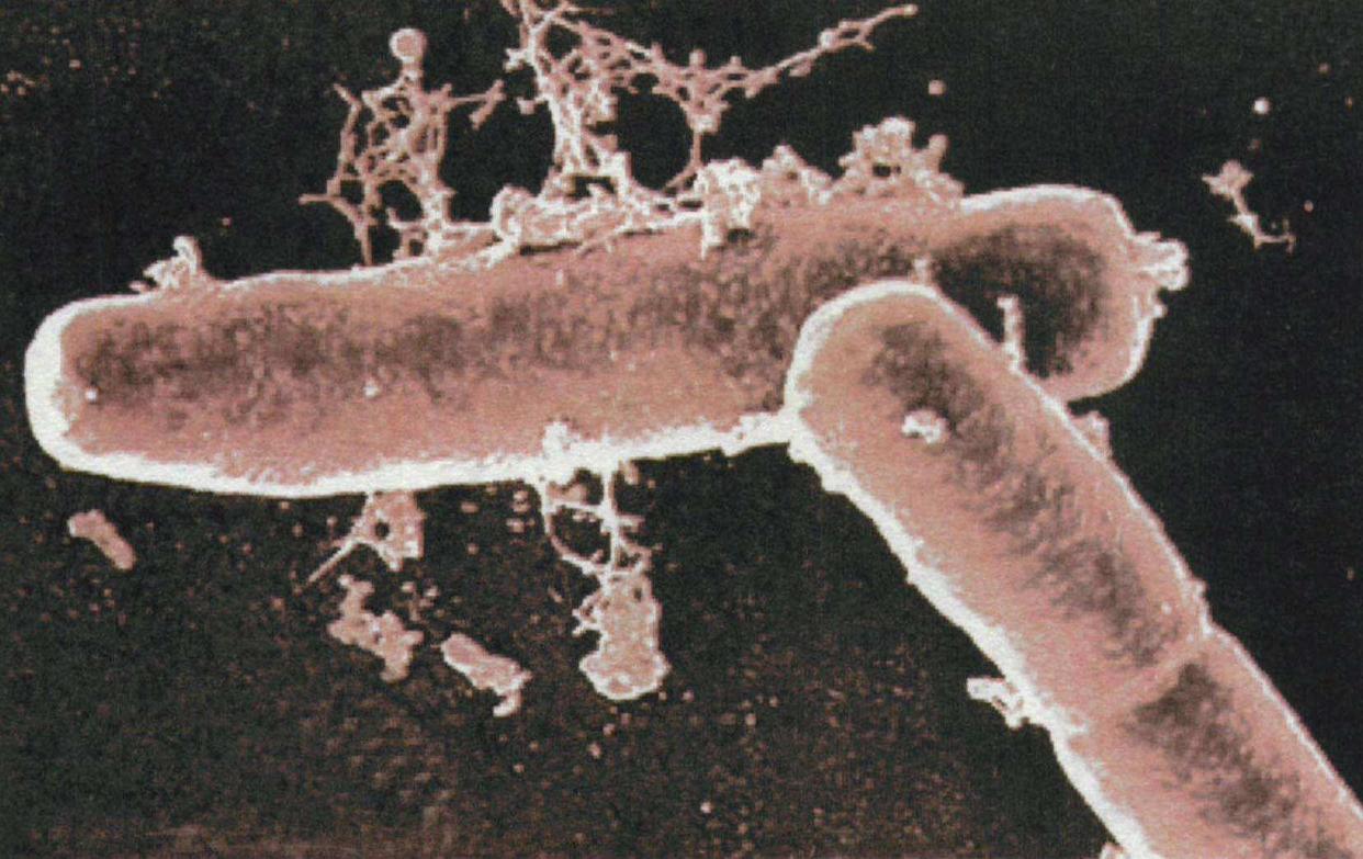 五种性传播的病,能通过性传播的疾病有哪些