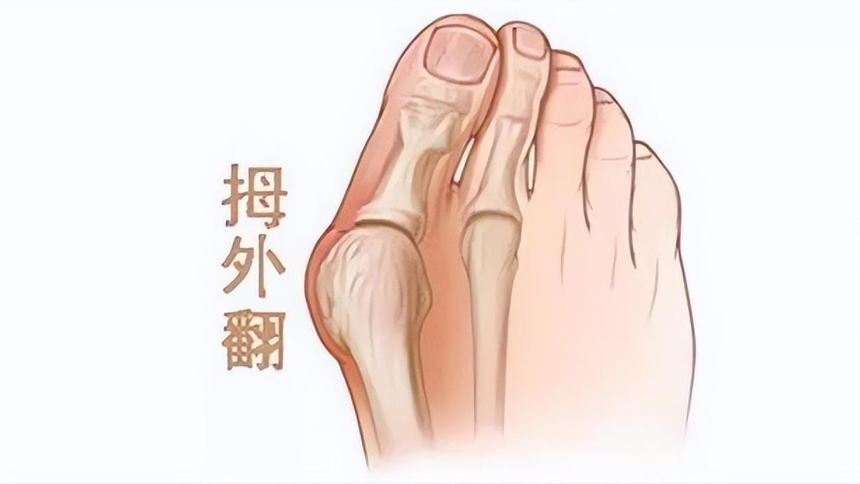 脚底板爱发烫是什么原因,脚底板生茧很疼怎么回事