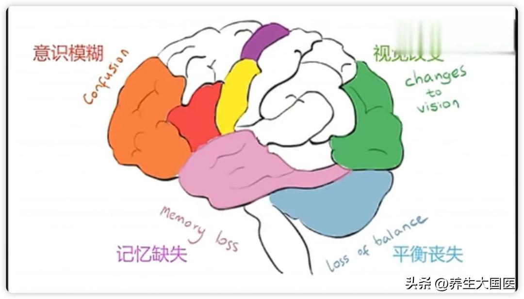卒中危险因素有哪些,卒中全程管理