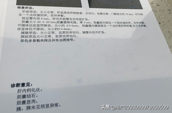 胆囊息肉未告知会被拒赔吗,胆囊息肉切除后后悔者自述