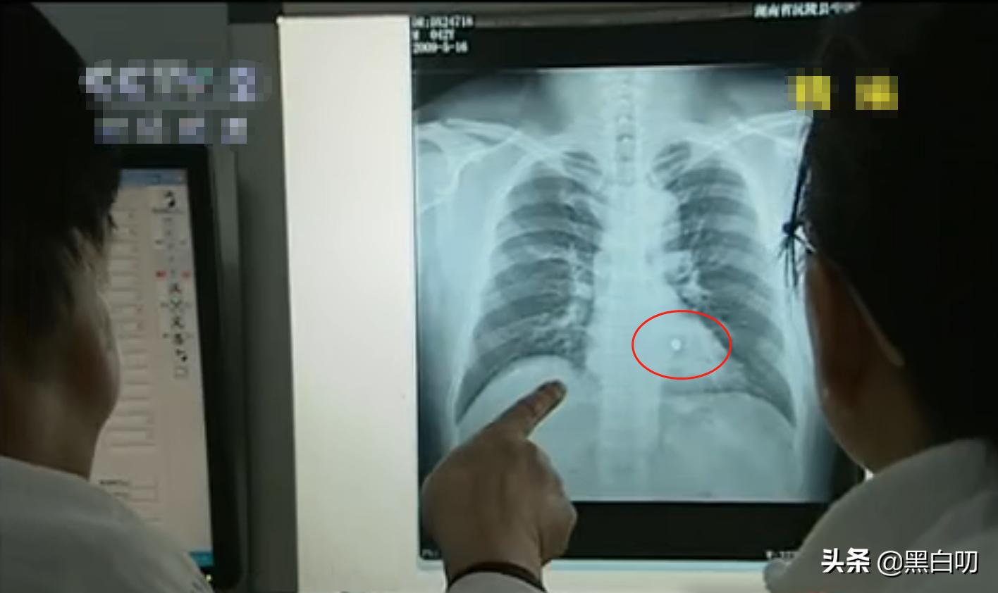 男子心脏不舒服不去医院,心脏不舒服去医院怎样查