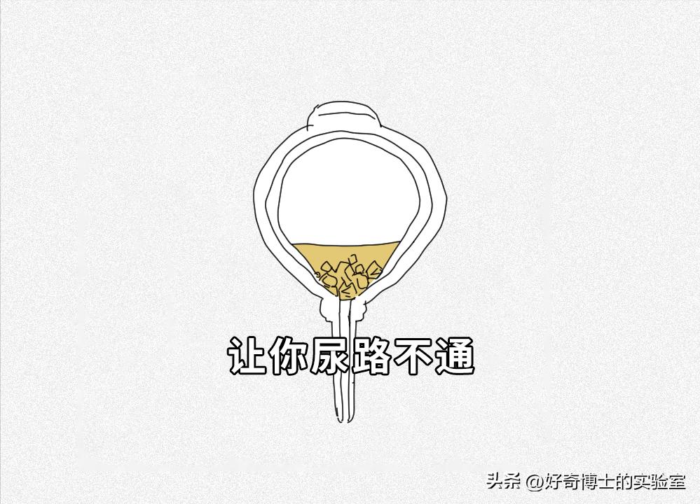 上厕所要等十几秒尿出来正常吗,晨尿要过几秒才能尿出来