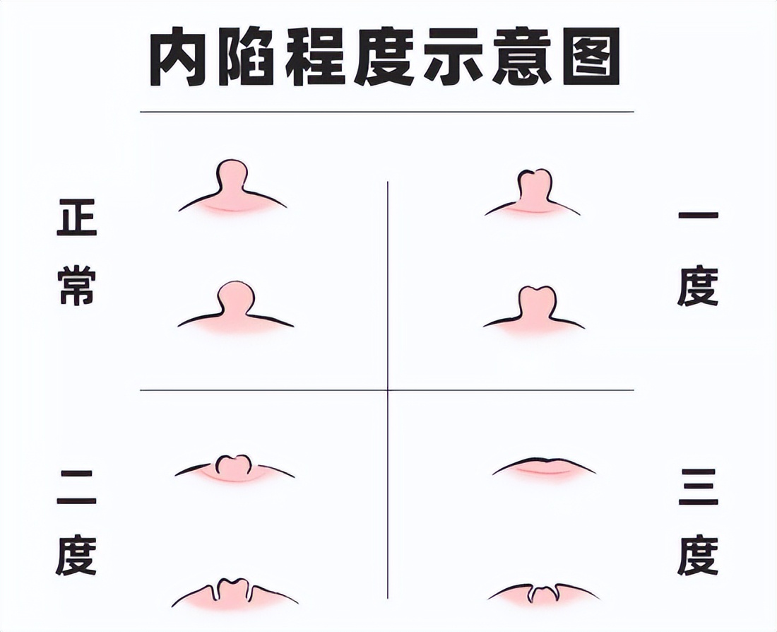 挤一挤总是有的,挤一挤总会有的下一句