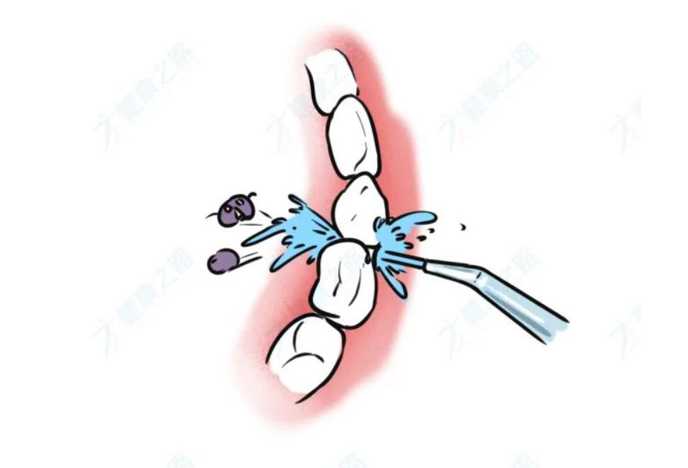 电动牙刷到底对牙齿好吗,电动牙刷真的比普通牙刷效果好吗