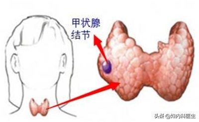 检查单上的指标怎么才能看懂？医生一文解释清楚