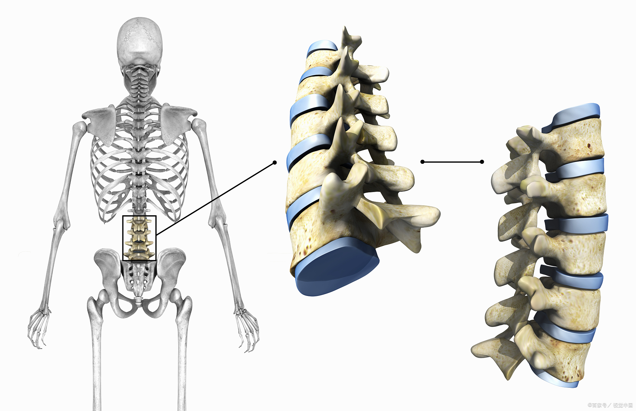 腰椎间盘突出保守需要多长时间,腰椎间盘突出保守治疗能痊愈吗