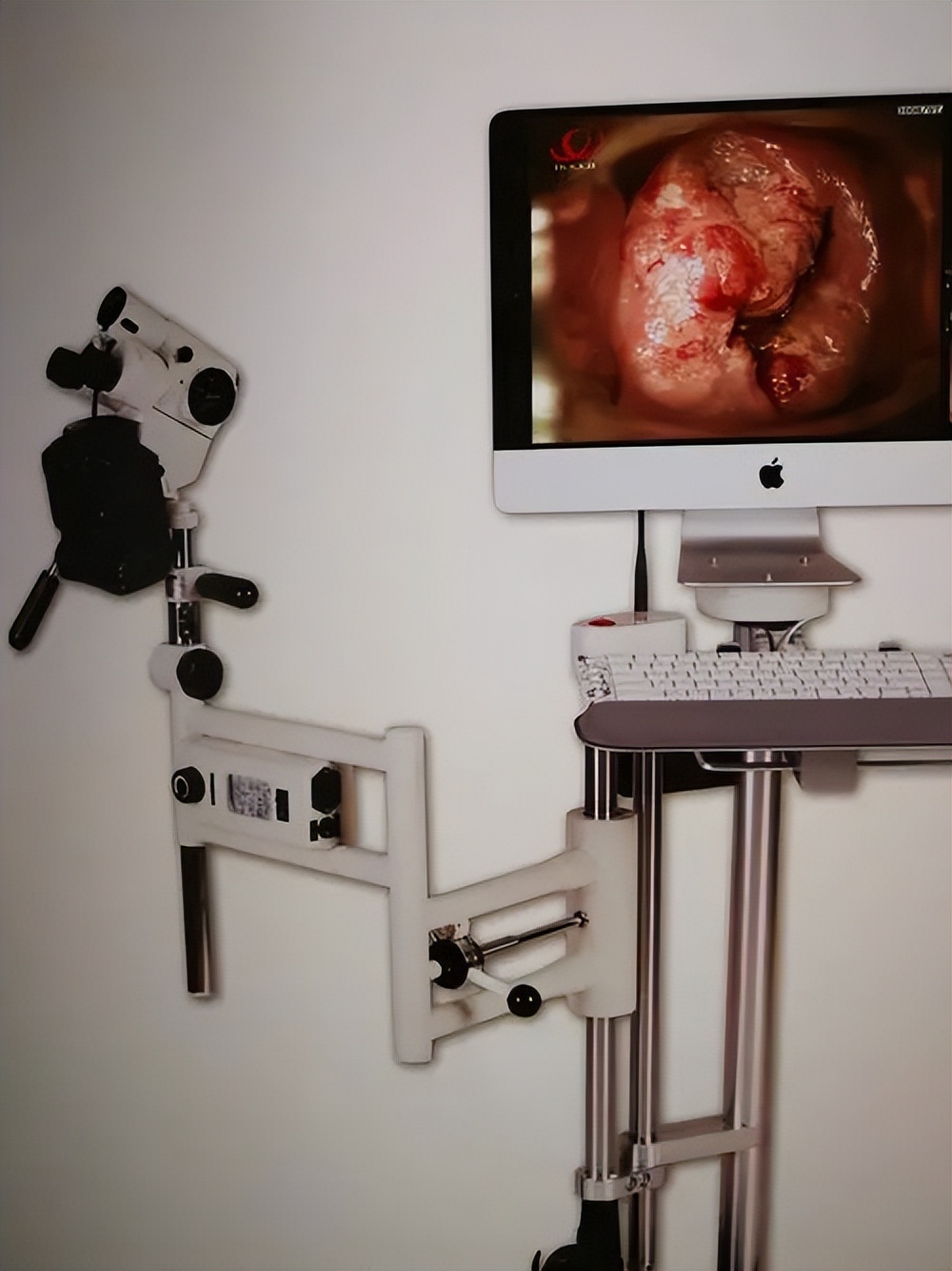 妇科检查多久该查一次,妇科检查宫颈癌怎么查