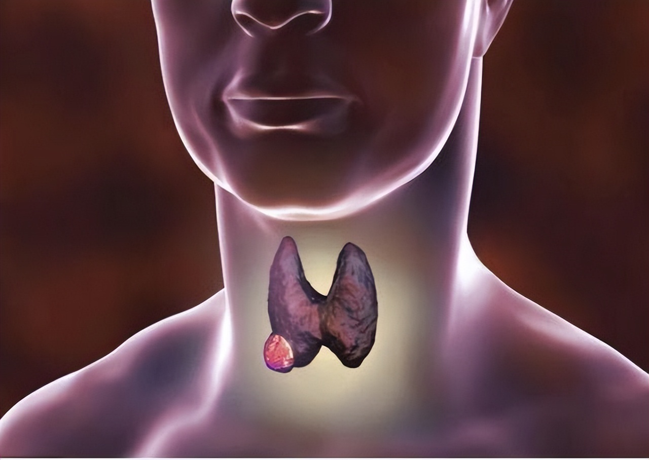 白萝卜到底是消结节还是长结节,萝卜是结节恶化的加速剂吗