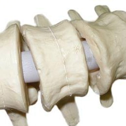 脊柱内镜术后感染的治疗策略