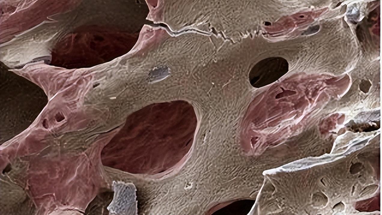 为什么女性过50岁就浑身疼,为什么女人到50浑身有病了