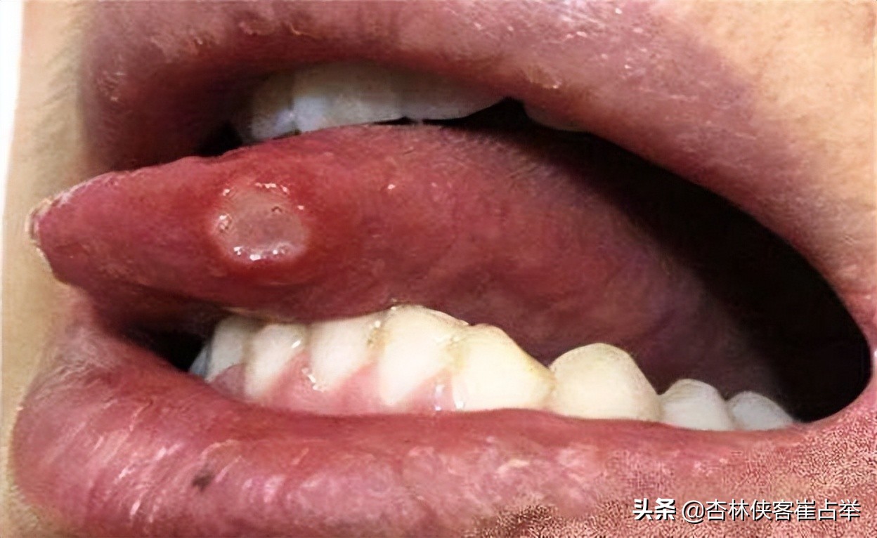 小便感觉上火,如果是上火会引起小便的地方痛吗