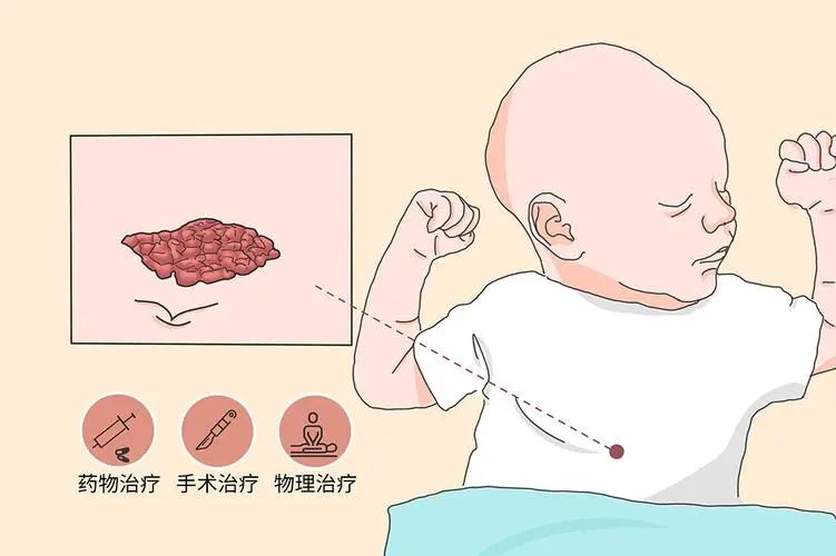 顺义市妇幼医院最新消息,血管瘤诊疗进展