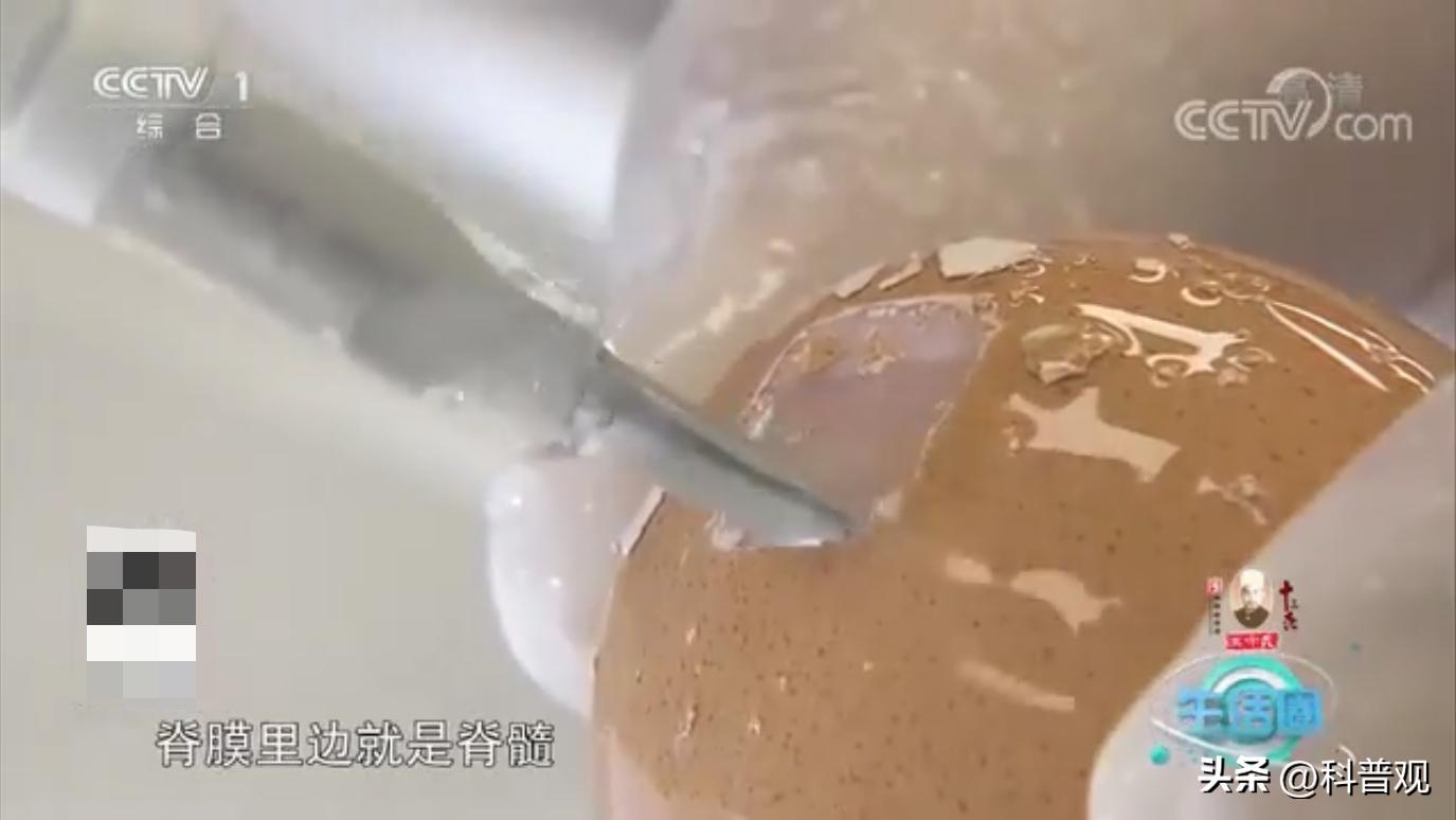 手术刀被垄断,美国垄断医疗器械