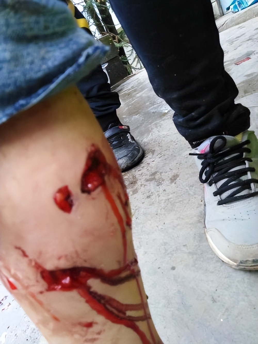 养的狗狗咬人算不算正当防卫,要你狗命原声