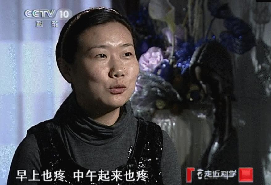 干细胞治疗关节炎2019,干细胞治疗膝关节央视