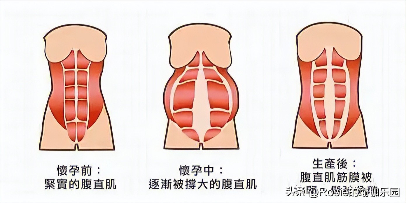 李念三胎产后复工状态,李念三胎是顺产吗